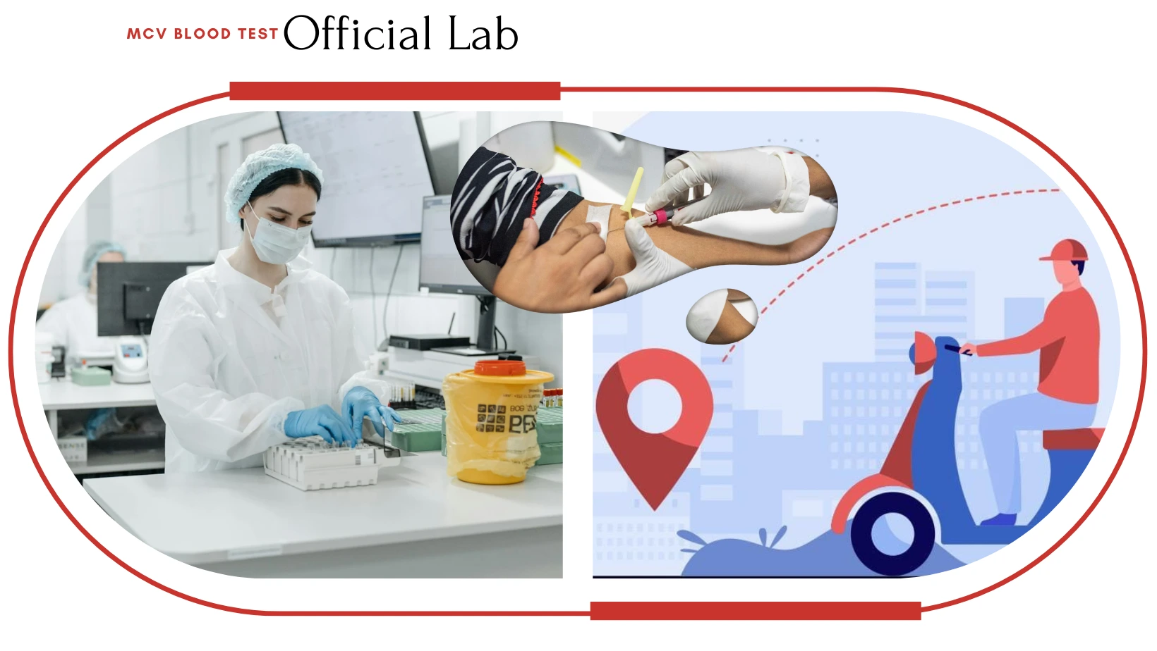 What is MCV Blood Test