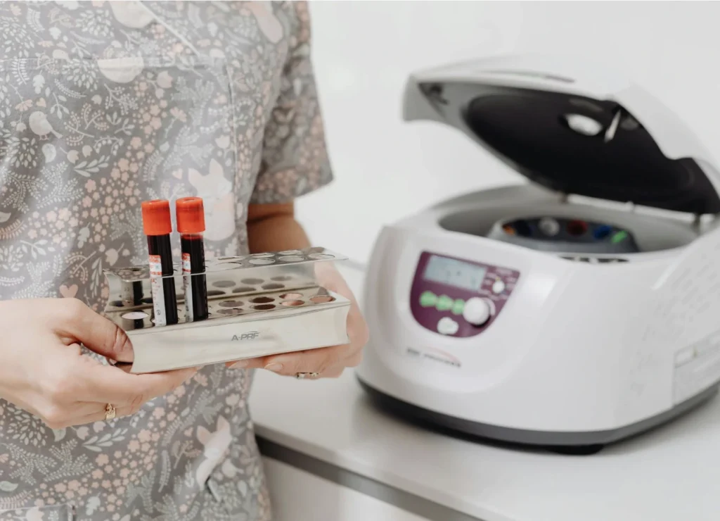 What is a Complete Blood Count (CBC) Blood Test?