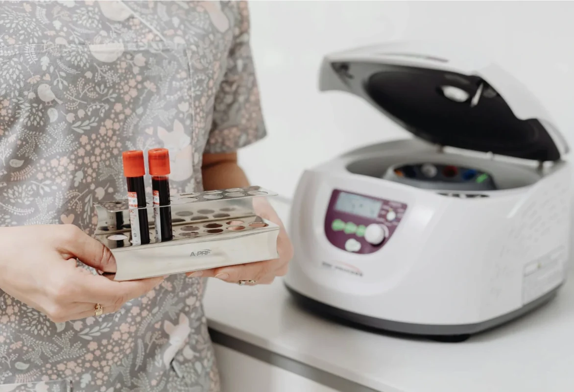 What is a Complete Blood Count (CBC) Blood Test?