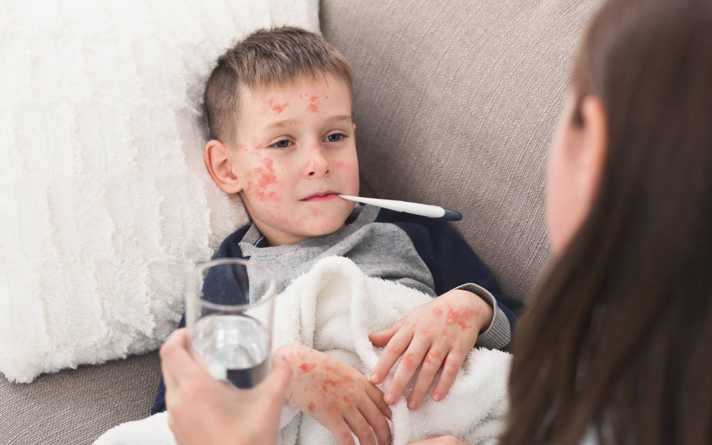 What Does Measles Rash Look Like?